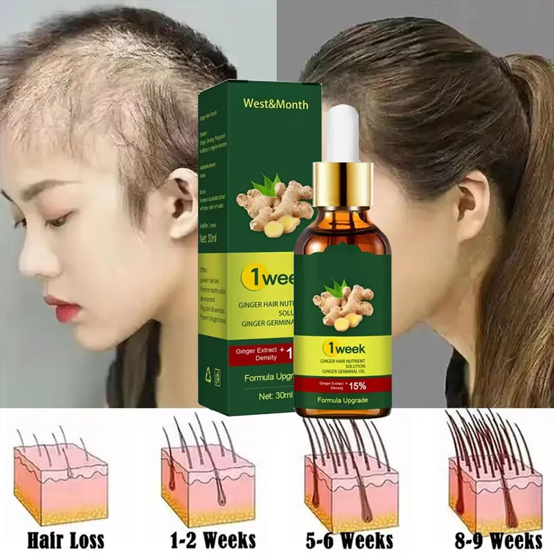 7 Days Ginger Hair Growth Prod - đánh giá và giá Licorice Root Sticks