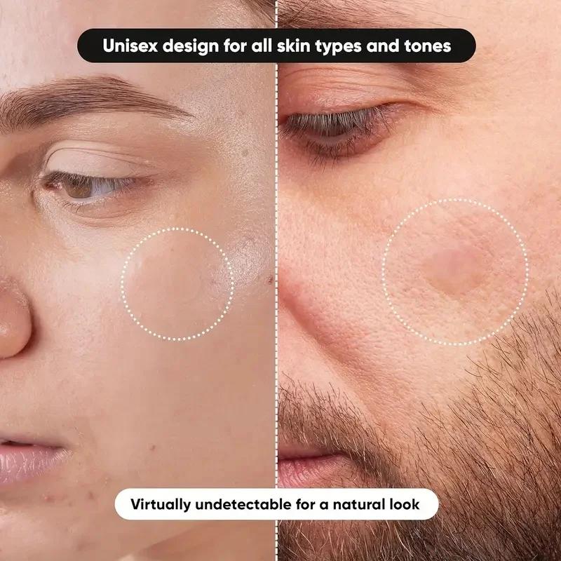 360 pieces/box acne patches -  - đánh giá và giá Essential Oils