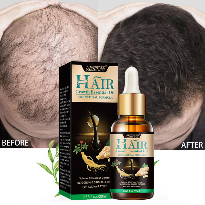 2023 Biotin Fast Hair Growth O - đánh giá và giá Licorice Root Sticks